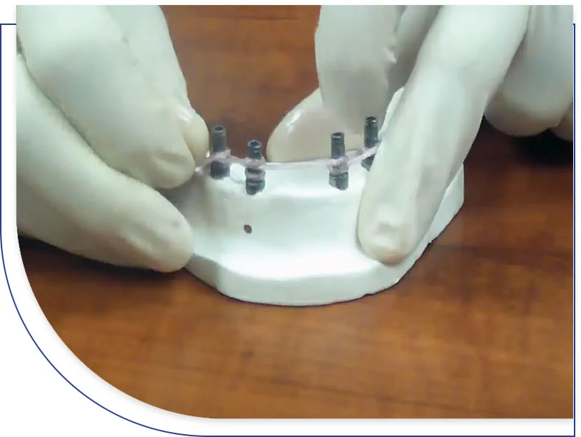 CST TEMP - Dental Supplies - Synca